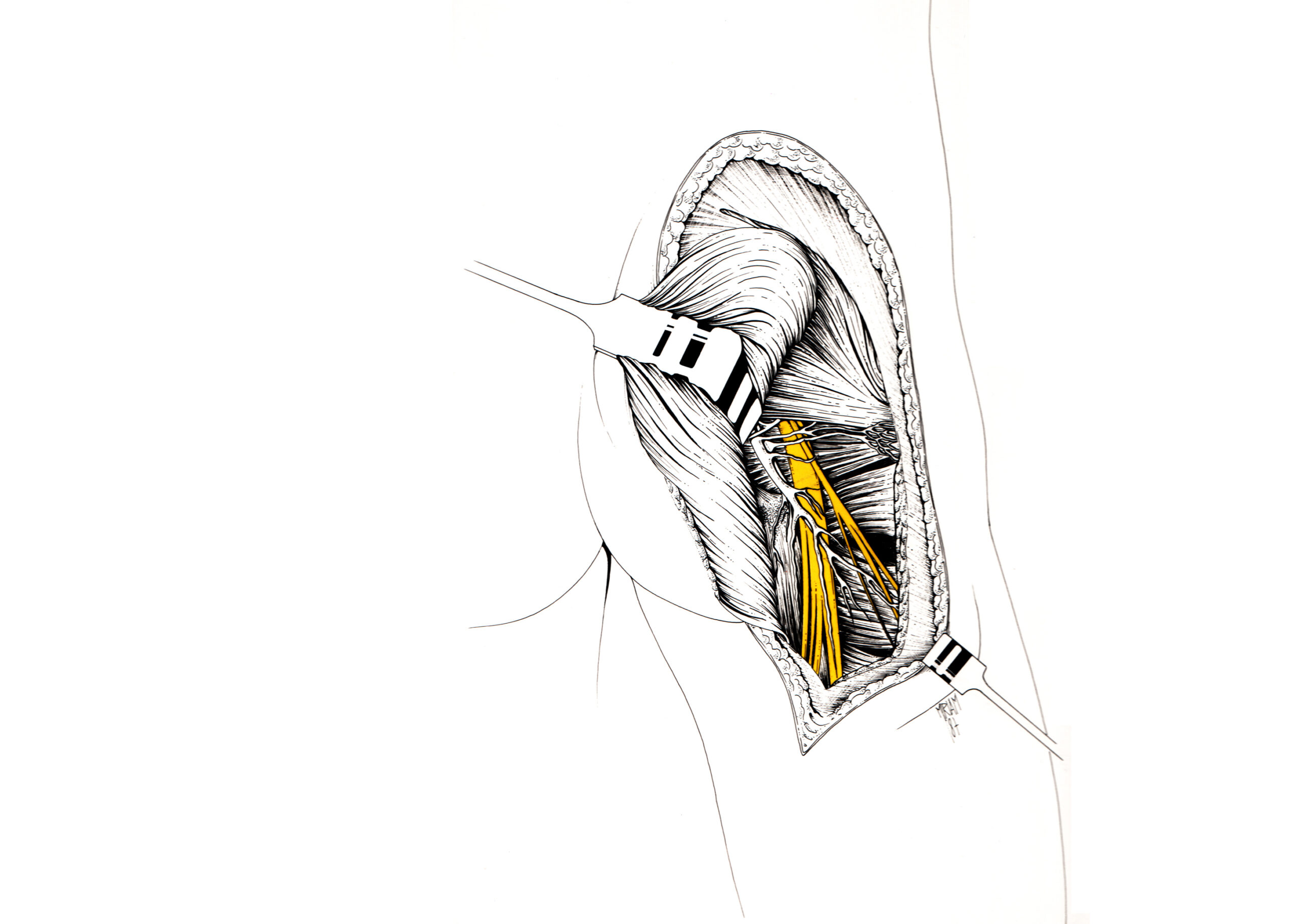 Disegno anatomo-chirurgico